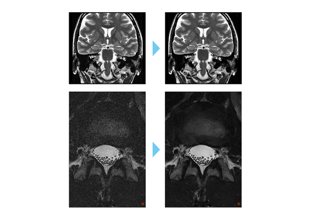 Deep Learning AIR™ IQ Edition(MR30)