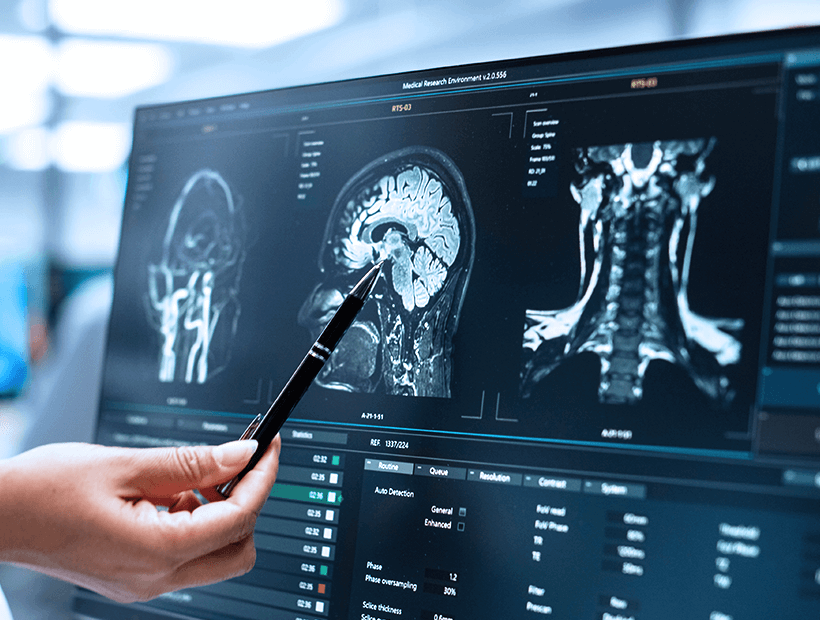 機能脳神経外科