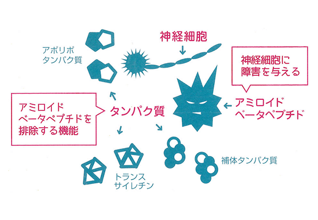 MCIスクリーニング検査